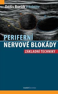 Periferní nervové blokády - Základní techniky