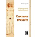 Karcinom prostaty